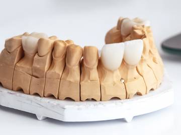 Are Dental Veneers Suitable for People with Diabetes?