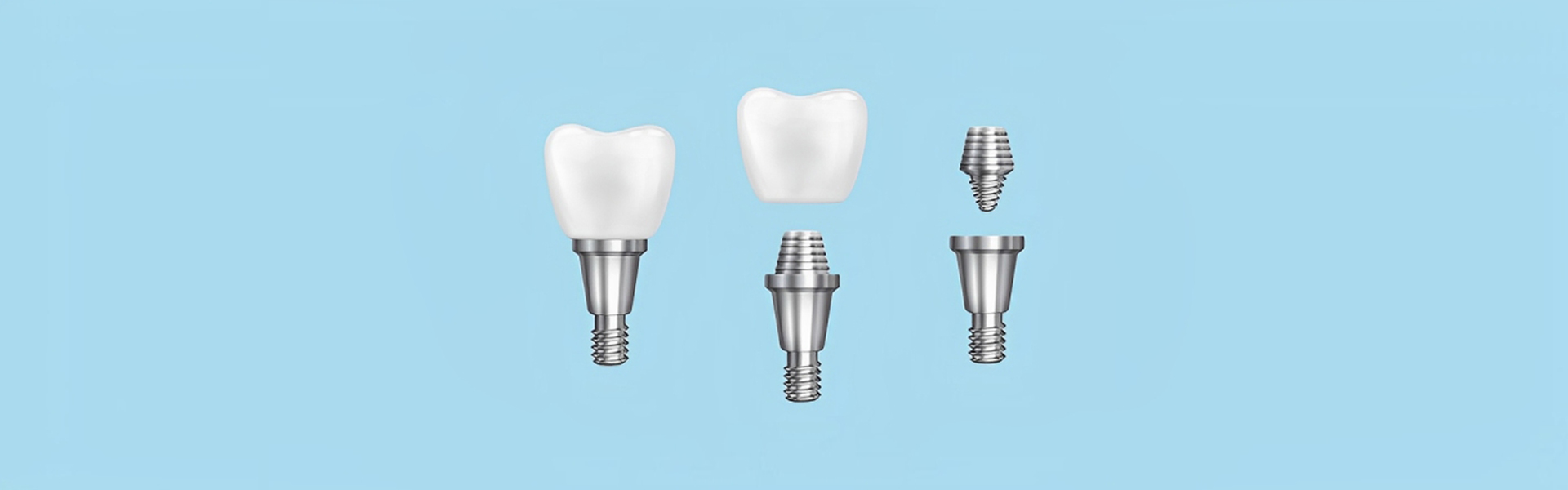 How to Care for Your Dental Implants and Ensure Longevity