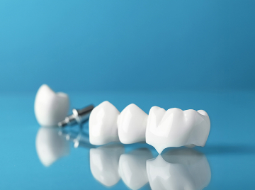 When Do You Need a Dental Crown? Signs and Solutions